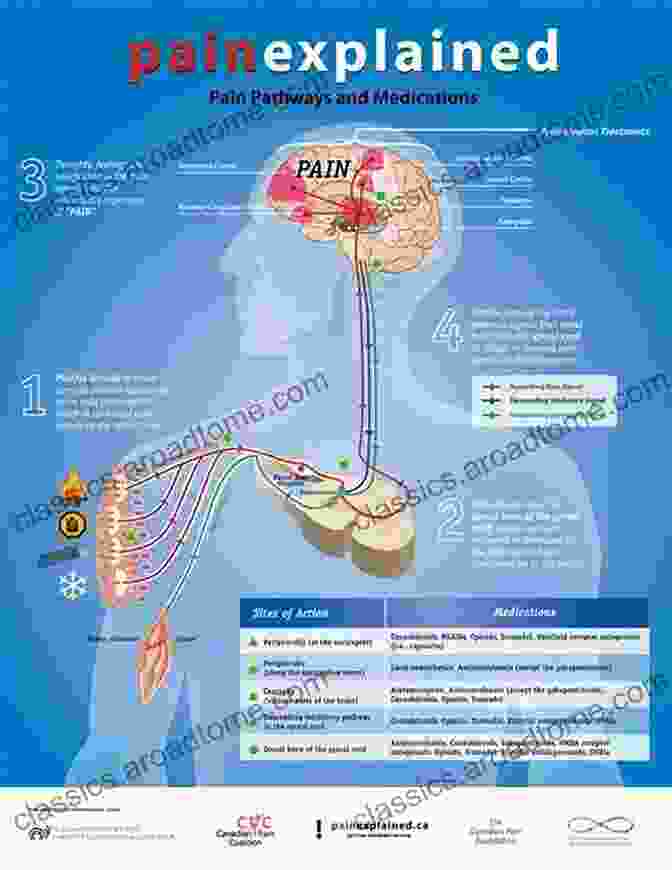 A Detailed Diagram Of The Human Body's Pain Pathways Where It Hurts And Why: How To Gain Control Of Your Pain