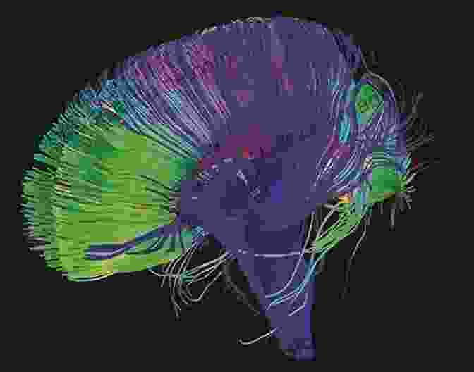 A Stylized Depiction Of The Brain And Body Interacting With Neural Pathways Making The Brain/Body Connection