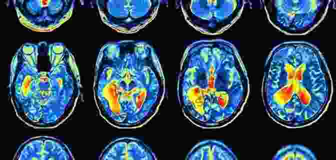 Intriguing Brain Scans Illustrate The Remarkable Neural Activity Triggered By Exposure To Black And White Images, Highlighting Their Impact On Brain Development. High Contrast Baby For Newborns Unicorns : Brain Development Pictures In Black And White 0 6 Months Clear Shapes For Infant From Birth