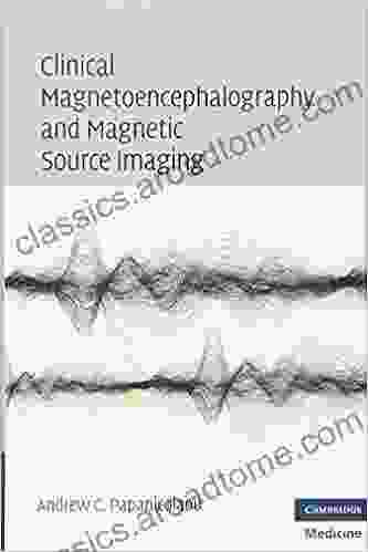 Clinical Magnetoencephalography and Magnetic Source Imaging